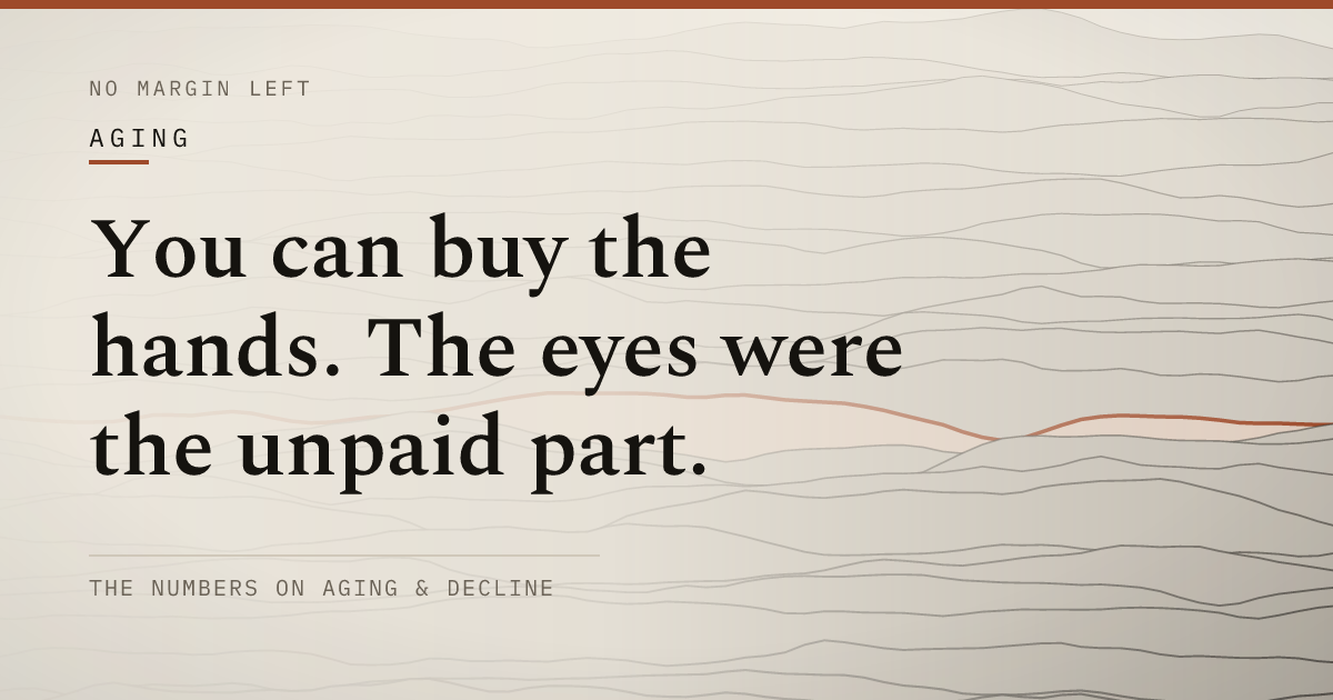 You can buy the hands. The eyes were the unpaid part.